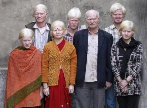 Самая большая в мире семья альбиносов